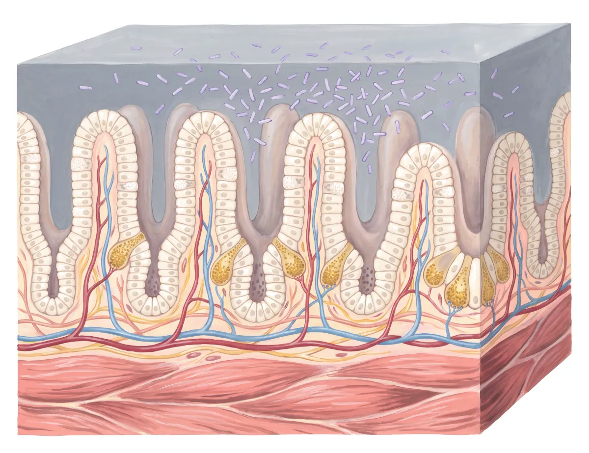 Planche : La muqueuse de l'intestin grêle, grossie. 1, Cellules entérochromaffines (90 à 95 % de la sérotonine du corps : transit irrégulier, diarrhée et constipation alternent) ; 2, Bactéries (en dysbiose, elles dégradent le tryptophane avant qu'il soit absorbé).