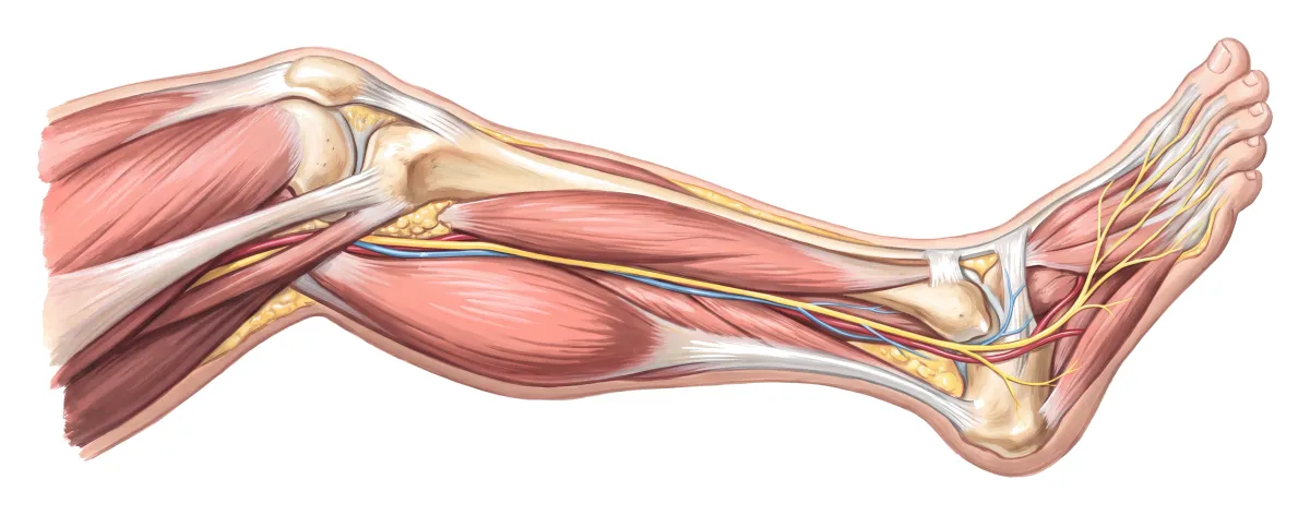 Planche : La jambe, vue par sa face interne. 1, Nerf de la jambe (des paresthésies symétriques, en bas des membres) ; 2, Nerfs du pied (la proprioception et le sens des vibrations se perdent) ; 3, Mollet (douloureux à la palpation) ; 4, Tendon d'Achille (le réflexe faiblit, voire disparaît).