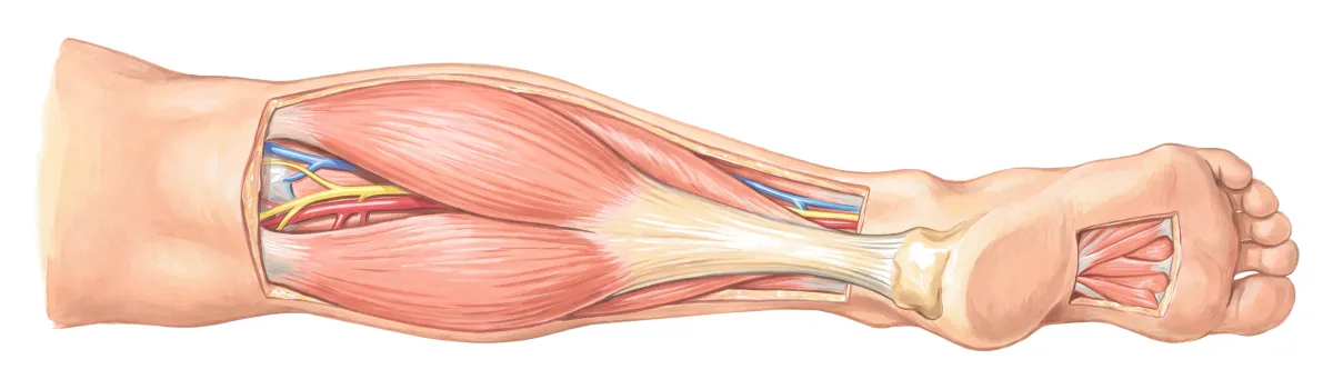 Planche : Le mollet et le pied, vus de dos. 1, Muscles du mollet (crampes la nuit) ; 2, Muscles de la plante du pied (crampes des pieds).