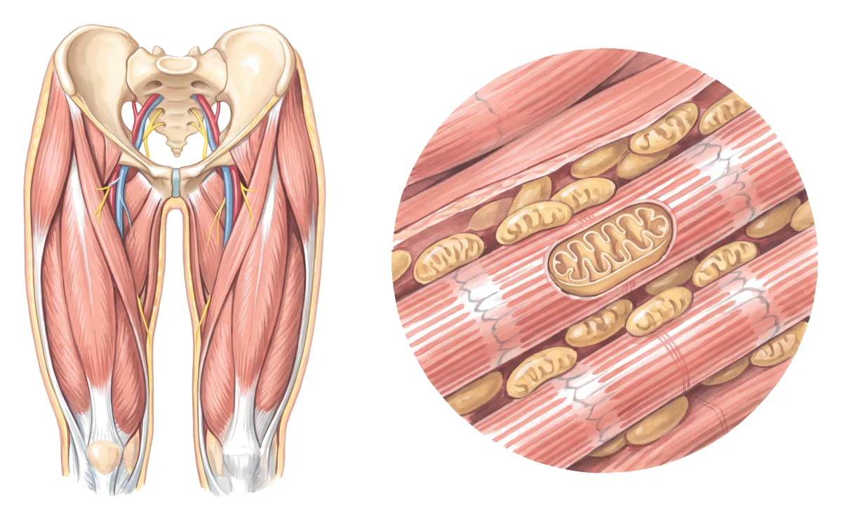 Planche : Les muscles de la hanche et des cuisses, et une fibre ouverte. 1, Muscles de la cuisse (une faiblesse proximale, des crampes à l'effort) ; 2, Mitochondries (le FAD leur manque : l'énergie de l'effort baisse).