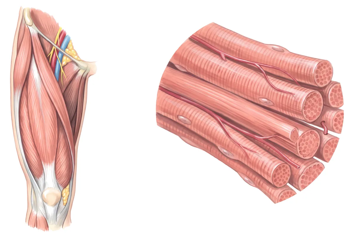 Planche : La cuisse et ses fibres musculaires. 1, Quadriceps (fatigue précoce à l'effort, crampes) ; 2, Fibres musculaires (moins sensibles à l'insuline : la tonicité se perd).