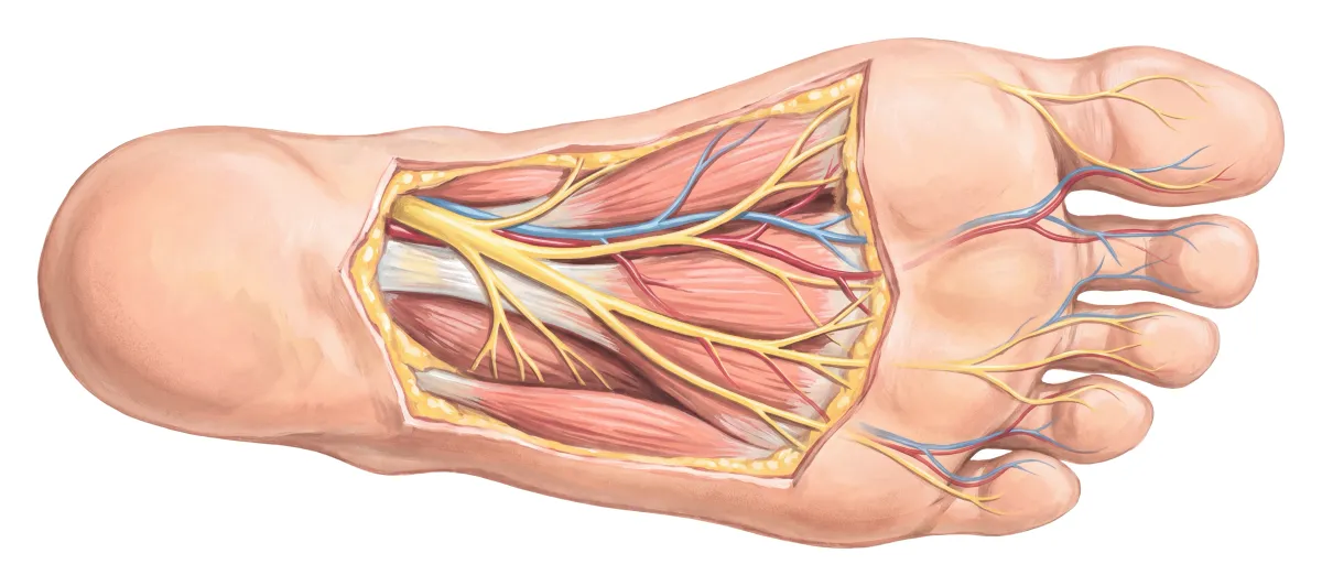 Planche : La plante du pied, ses nerfs. 1, Nerfs plantaires (brûlures, picotements : le « burning feet syndrome ») ; 2, Nerfs des orteils (fourmillements).