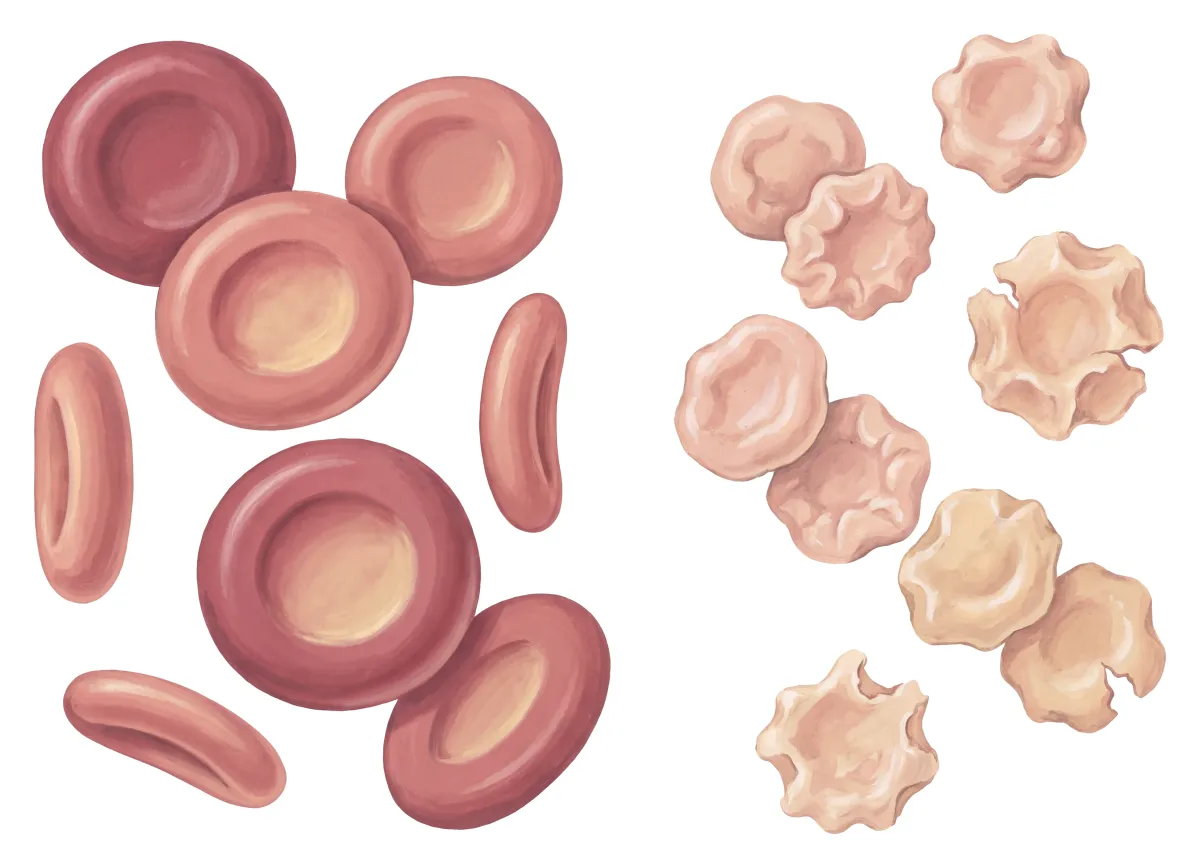 Planche : Des globules rouges, au fort grossissement. 1, Globules rouges (le repère) ; 2, Globules rouges usés (soumis au stress oxydant, ils vieillissent avant l'heure).