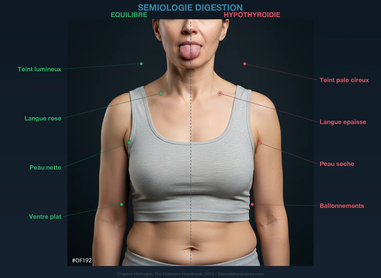 Sémiologie digestion et thyroïde : signes cliniques visibles de l'hypothyroïdie digestive