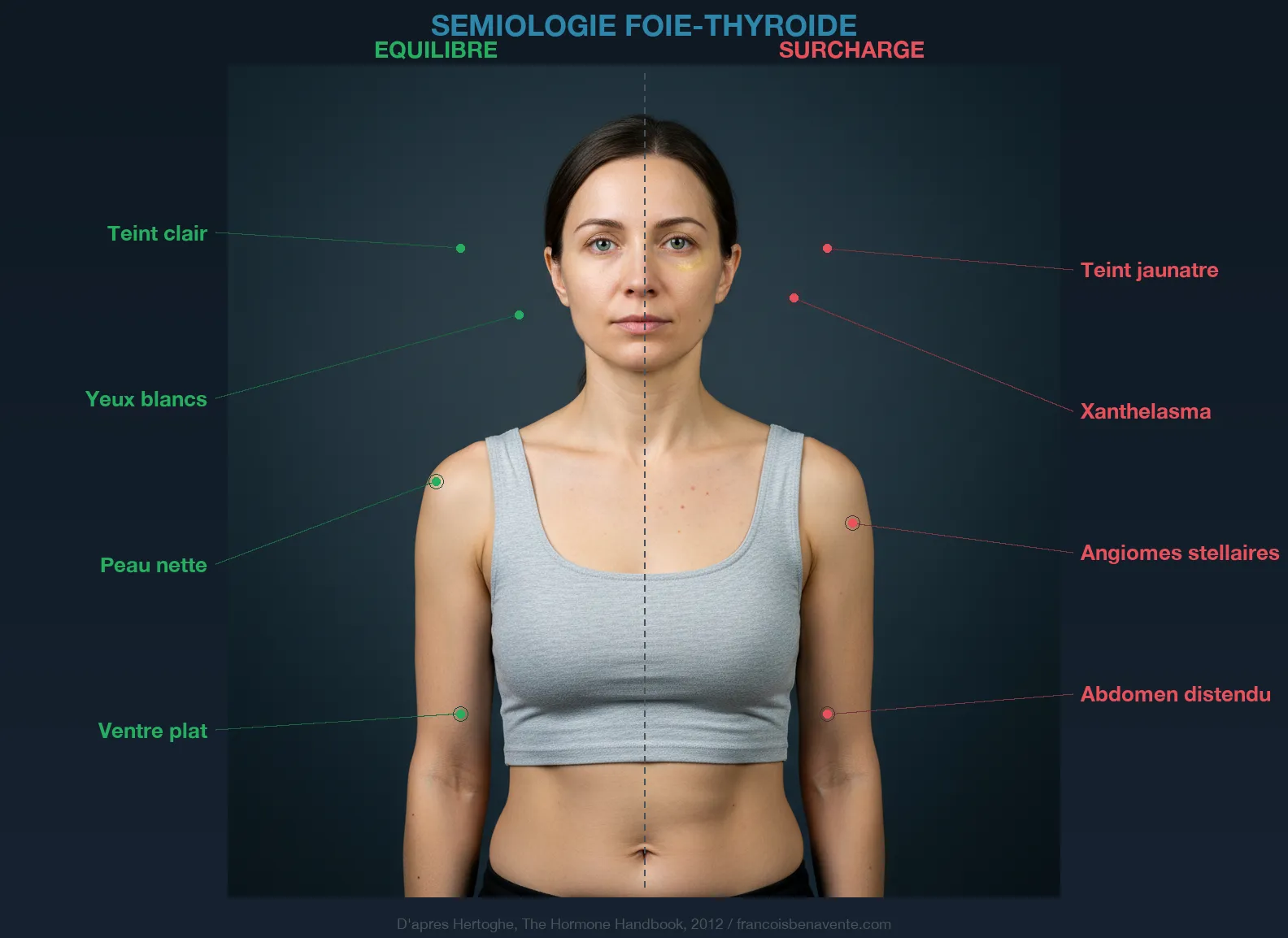 Sémiologie foie-thyroïde : signes cliniques de surcharge hépatique liée à l'hypothyroïdie