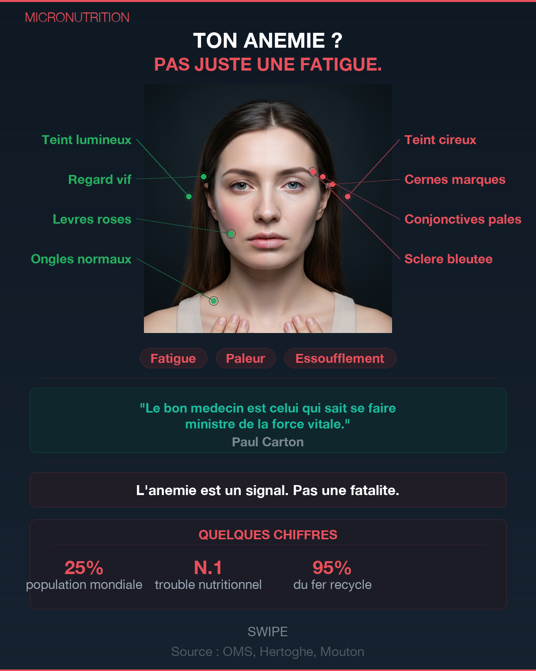 Anémie : les 4 vraies causes qu'on ne cherche pas