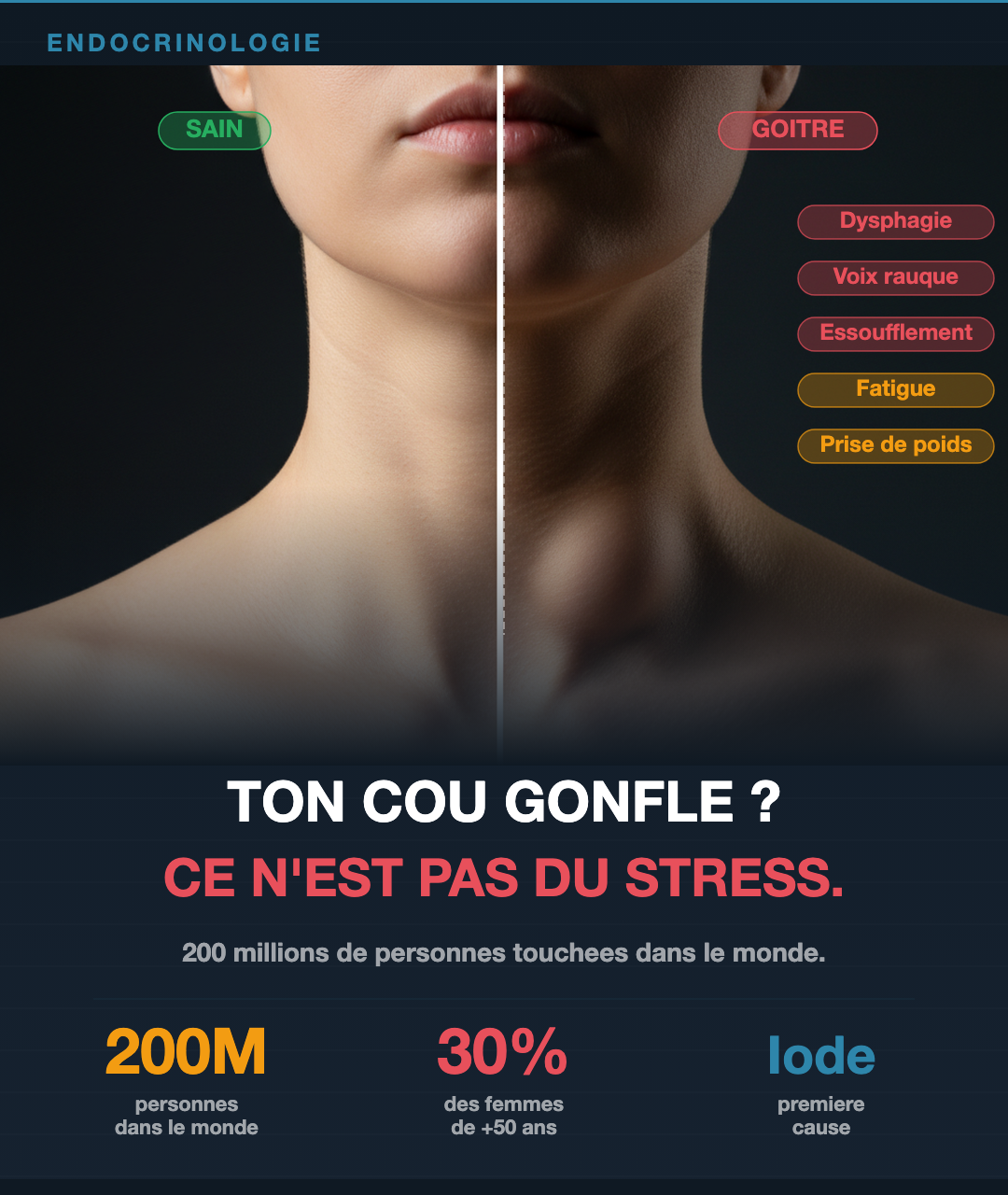 Goitre : ce que ta thyroïde qui gonfle raconte
