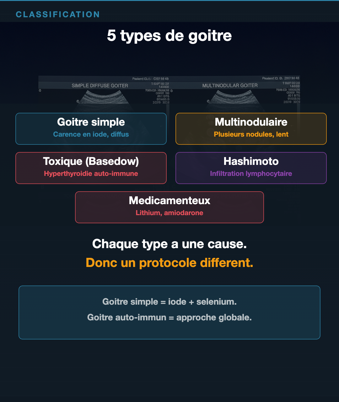 Goitre : ce que ta thyroïde qui gonfle raconte : Slide 4