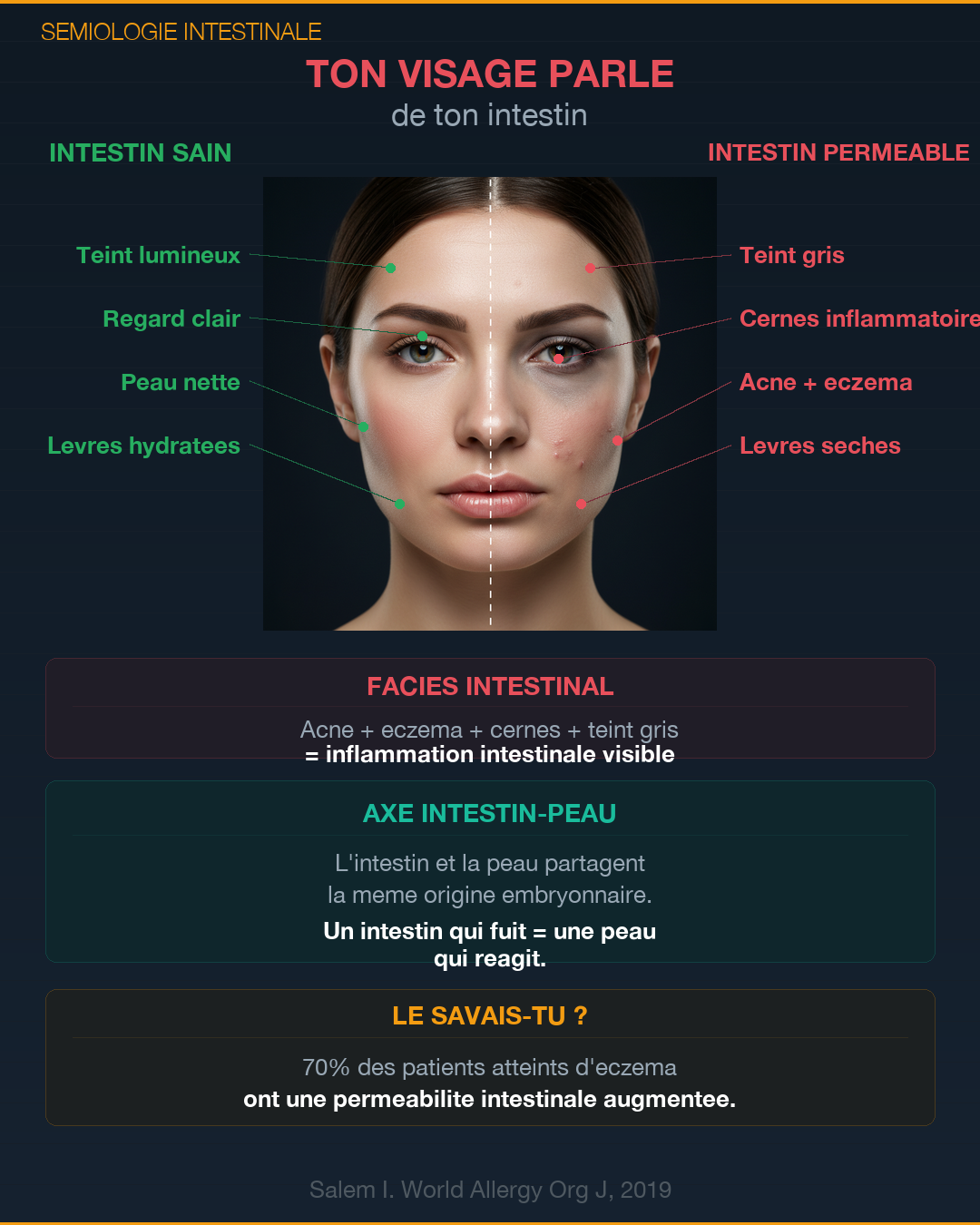 Perméabilité intestinale : l'intestin qui fuit : Slide 4