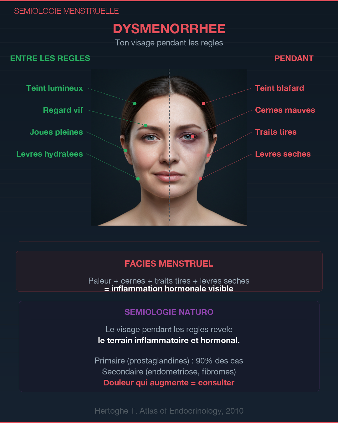 Règles douloureuses : causes et solutions naturelles : Slide 4