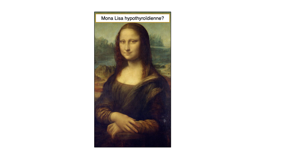 Mona Lisa hypothyroïdienne ? (analyse Dr Hertoghe)