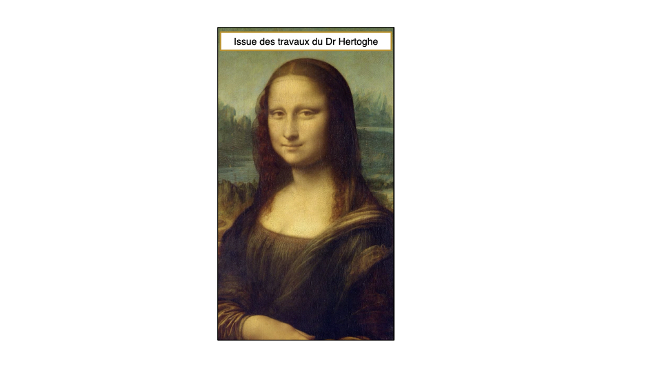 Sémiologie Hertoghe : les signes de l'hypothyroïdie